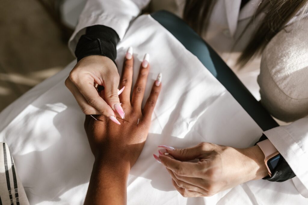 mulher em clinica de terapia holistica realizando acupuntura